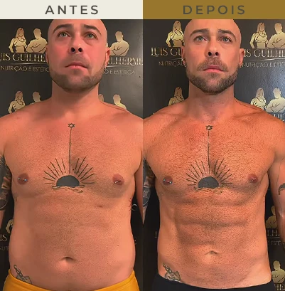 resultado nutricionista em são paulo 1