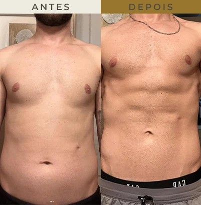 resultado nutricionista em são paulo 2