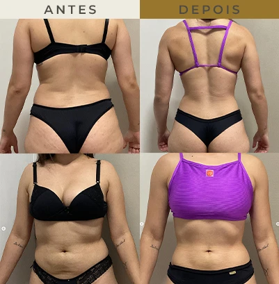resultado nutricionista em são paulo 4