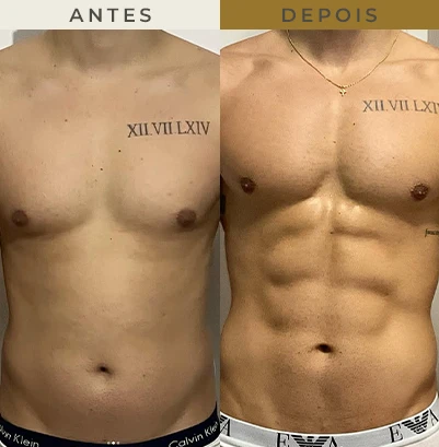 resultado nutricionista em são paulo 5